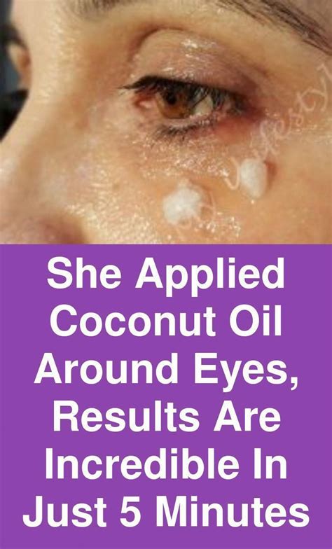 She Applied Coconut Oil Around Eyes Results Are Incredible In Just