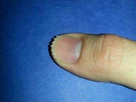 Thanks I Hate Serrated Fingernails R Tihi