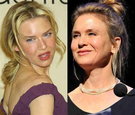 Renee zellweger and ant antstead are reportedly dating. Renee Zellweger Spekulation für Plastische Chirurgie ...