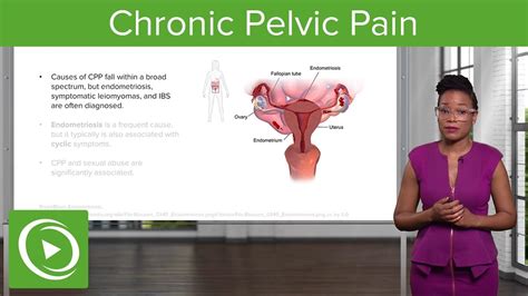 Chronic Pelvic Pain CPP Definition Diagnosis Management Gynecology Lecturio YouTube