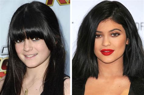 did kylie almost end up on botched jenner admits she took the lip fillers too far daily star
