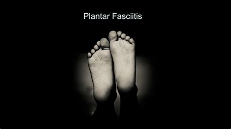 This systematic review aimed to determine the effectiveness of acupuncture in reducing pain caused by plantar fasciitis. Raleigh Acupuncture Plantar Fasciitis Treatment Works Best