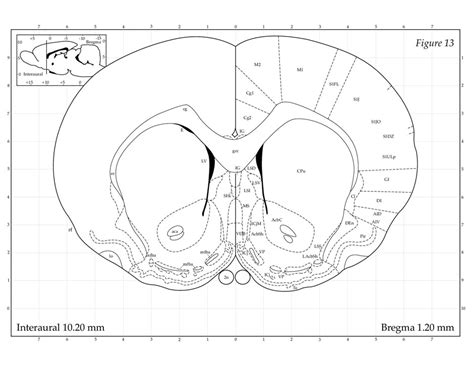 The brainspan project is a detailed atlas of gene expression across human development. rat brain atlas - Mfddr