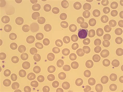 Red Blood Cell Maturation A Laboratory Guide To Clinical Hematology
