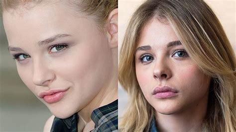 Chloë Grace Moretz Plastic Surgery Transformation Celebrity Plastic