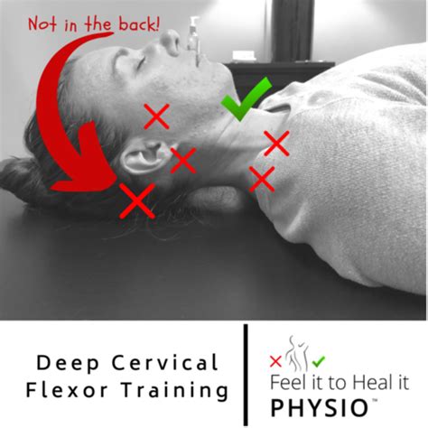 Deep Cervical Flexor Dysfunction With Cervicogenic Dizziness