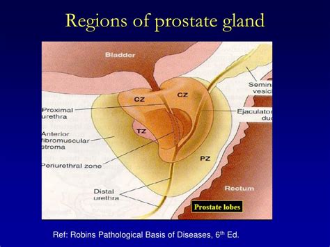 Ppt Pathology Of Prostate Gland Powerpoint Presentation Free Download Id