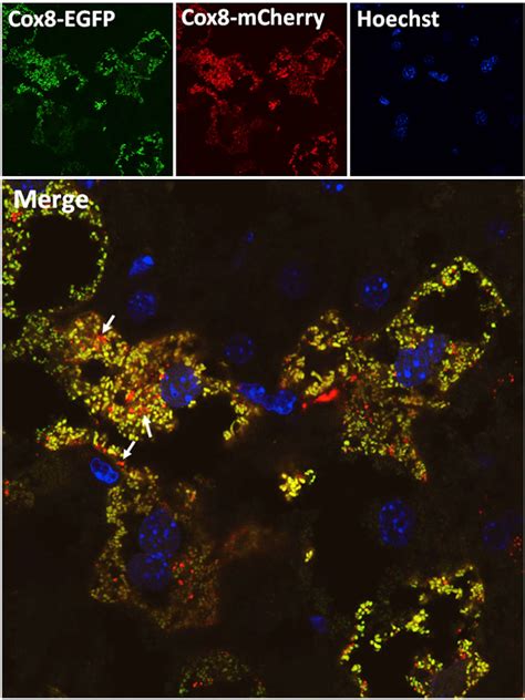 Figure 3 From A Fluorescence Imaging Based Assay To Monitor Mitophagy