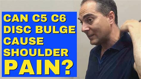 Can C5 C6 Disc Bulge Cause Shoulder Pain Dr Walter Salubro