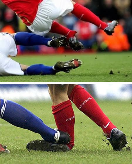 12 Of The Worst Soccer Injuries Of All Times Soccer Injury Worst