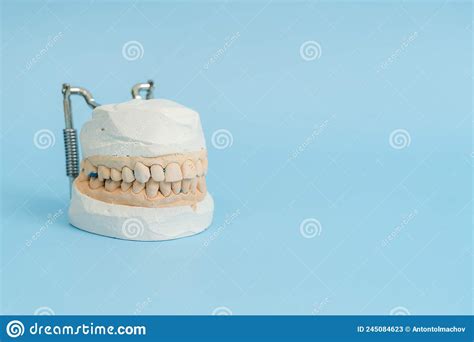 Model Of Teeth And Gums On Blue Background Dental Concept Stock Image