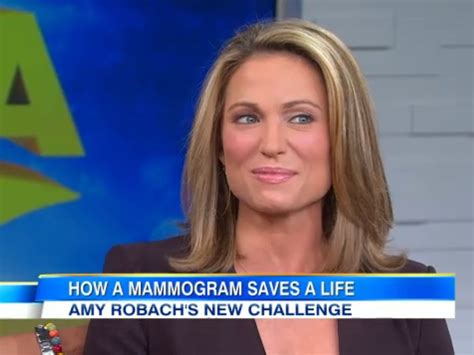 Good Morning America Host Amy Robach Will Undergo Double Mastectomy After On Air Mammogram