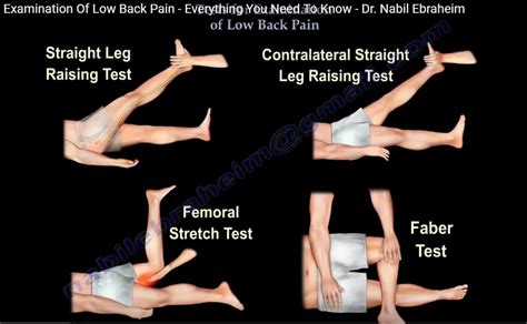 Clinical Examination For Low Back Ache OrthopaedicPrinciples Com