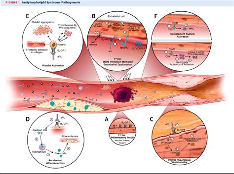 Figure 1 From Antiphospholipid Syndrome Role Of Vascular Endothelial Cells And Implications For