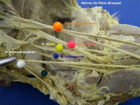 Plexo Braquial Anatomia Veterin Ria I