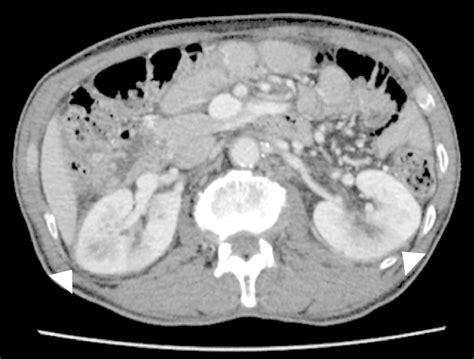 A Dynamic Contrast Enhanced Computed Tomography Image Of The Kidney