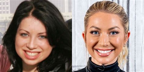 Vanderpump Rules Star Stassi Schroeder Says Getting A Chin Implant Was One Of The Best Things