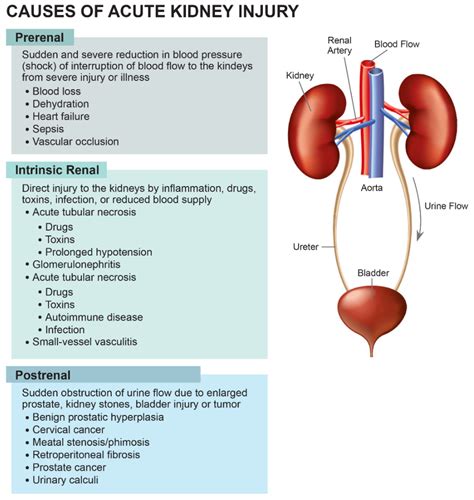 Jcm Free Full Text Diagnostics Risk Factors Treatment And Outcomes Of Acute Kidney Injury