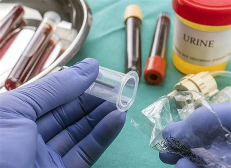 Understanding Urine Samples And Blood Testing During Drug Treatment And