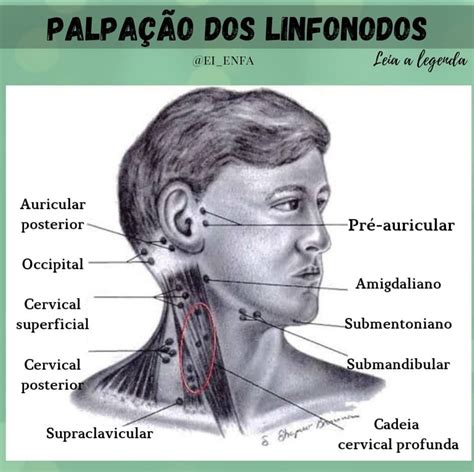 Palpação Dos Linfonodos Semiologia Médica