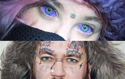 Share More Than 80 Eyeball Tattoo Gone Wrong Esthdonghoadian