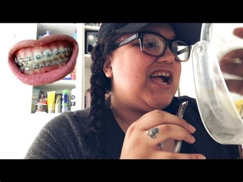 Before putting wax on the wire, brush, and floss your teeth properly to remove all the food debris. How To Remove Braces At Home | - YouTube