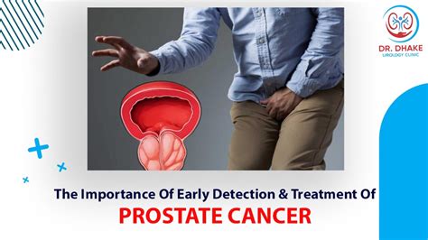The Importance Of Early Detection And Treatment Of Prostate Cancer Dr Rajesh Dhake