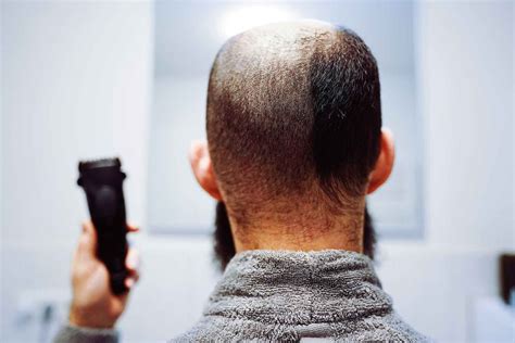 Glatze Oder 3mm Welcher Haarschnitt Ist Die Richtige Wahl Wenighair