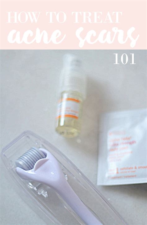 Acne Scar Treatment 101 How To Heal Acne Scars Marks The Dumbbelle