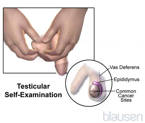 Cfnm Testicular Exam Telegraph
