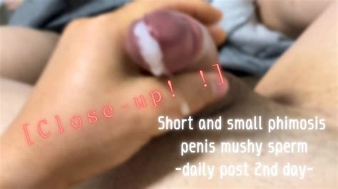 Close Up Short And Small Phimosis Penis Mushy Sperm Daily Post 2nd Day Xxx Videos Porno