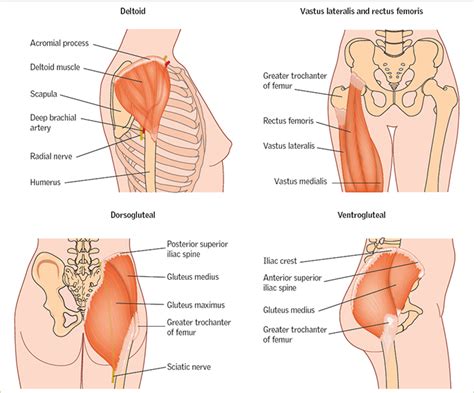 Ventrogluteal Injection Site