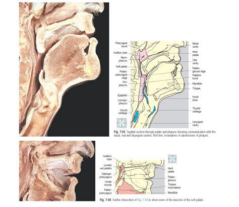 Palate Anatomy Pediagenosis