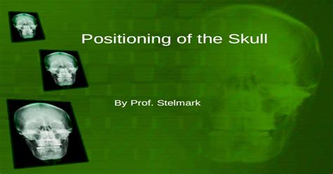 Positioning Of The Skull Ppt Powerpoint
