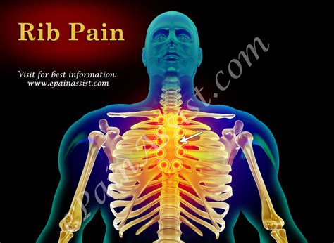 Rib Cage Pain 4 Ways To Get Rid Of Intercostal Muscle Pain Infused