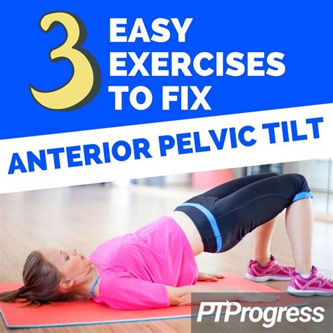 Easy Methods To Repair Anterior Pelvic Tilt My Blog