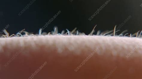 Arm Hairs Stock Video Clip K0056149 Science Photo Library
