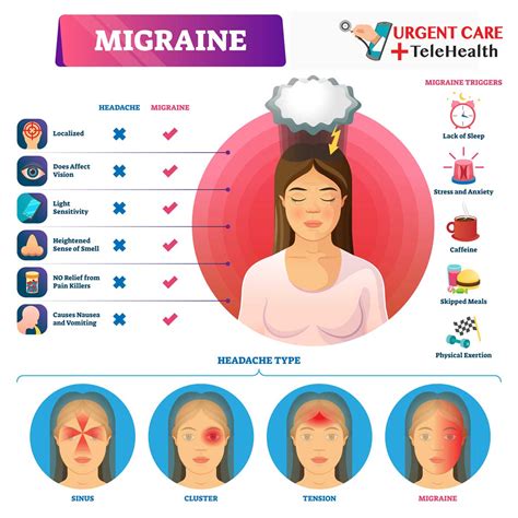 Headache Map Headache Chart Headache Types Migraine Headaches Types