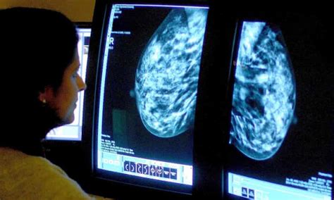 Cancer Rates Set To Increase Six Times Faster In Women Than Men