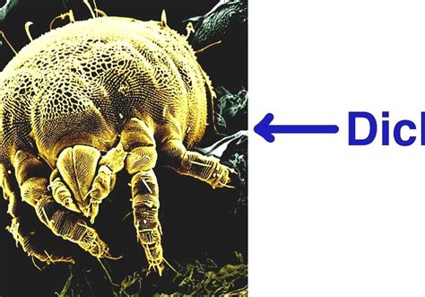 House Dust Mite Can You See Dust Mites With The Human Eye