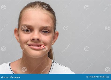 Portrait Of A Ten Year Old Girl With A Tampon That Sticks Out Of Her Mouth After Tooth