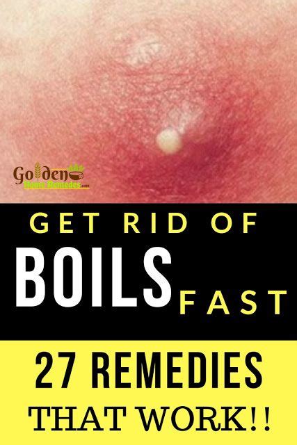 9 Best Boils Ideas Home Remedy For Boils Health Remedies Natural