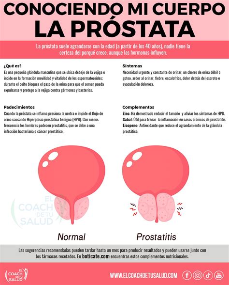 Trata La Prostatitis De Manera Natural El Coach De Tu Salud