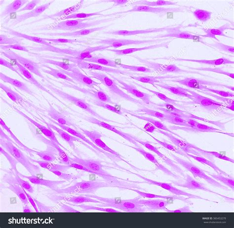 Real Fluorescence Microscopic View Human Skin Stok Fotoğrafı 385453279
