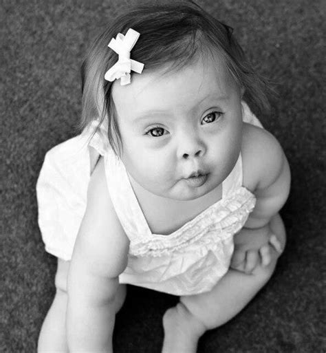 Beautiful Baby Girl W Down Syndrome ♥ Extra Chromosome Pinterest
