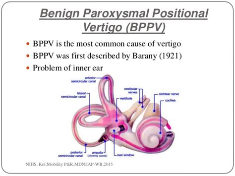 Vertigo exercises are designed to treat peripheral vertigo caused by benign paroxysmal positional vertigo (bppv). Vestibular rehabilitation: PhysioNow Mississauga, Vertigo