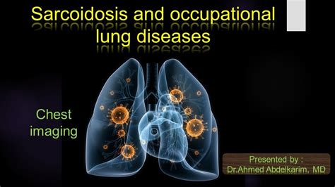 8 Sarcoidosis And Occupational Lung Diseases Youtube