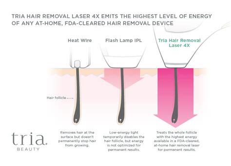 Tria Beauty Hair Removal Laser 4x Review At Home Laser Hair Removal