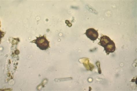 Depending on the types of crystals that your dog presents when he pees, the amount of protein he eats will be reduced and you will be recommended to give him diuretic and vitamin c foods. Urology - Veterinary Medicine Vet 40000 with Doherty at ...