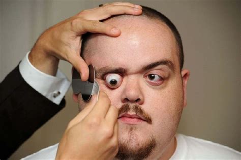If Your Eyeball Pops Out Of Your Head You Can Just Push It Back In And
